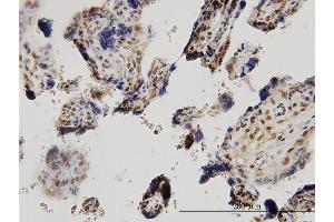 Immunoperoxidase of monoclonal antibody to SMAD2 on formalin-fixed paraffin-embedded human placenta. (SMAD2 抗体  (AA 181-280))