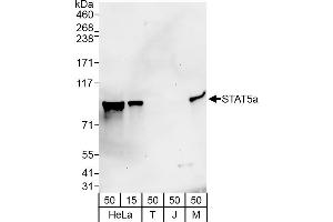 Western Blotting (WB) image for anti-Signal Transducer and Activator of Transcription 5A (STAT5A) (AA 744-794) antibody (ABIN7453648)