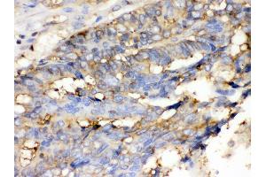 Immunohistochemistry (IHC) image for anti-Cofilin 1 (CFL1) (AA 122-152), (C-Term) antibody (ABIN3042746)