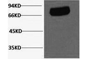 Western Blotting (WB) image for anti-Transferrin (TF) antibody (ABIN5962683) (Transferrin 抗体)