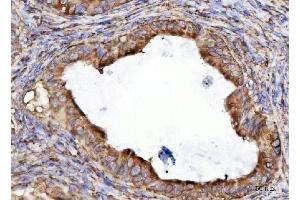 IHC analysis of RPL36 using anti-RPL36 antibody (ABIN7602917).