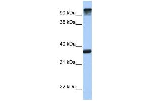 WB Suggested Anti-EPS15 Antibody Titration: 0. (EPS15 抗体  (C-Term))