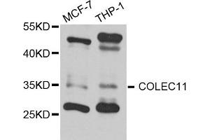Western blot analysis of extract of MCF7 and THP1 cells, using COLEC11 antibody. (COLEC11 抗体)