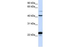 Image no. 1 for anti-EVX1 (EVX1) (AA 36-85) antibody (ABIN6744223) (EVX1 抗体  (AA 36-85))