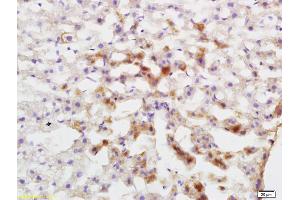 Immunohistochemistry (IHC) image for anti-Cytochrome P450, Family 1, Subfamily A, Polypeptide 2 (CYP1A2) (AA 221-320) antibody (ABIN742470)