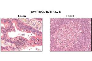Immunohistochemistry detection of endogenous TRAIL-R2 in paraffin-embedded human carcinoma tissues (colon, tonsil) using mAb to TRAIL-R2 (TR2. (TNFRSF10B 抗体)