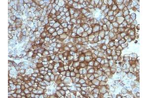 Image no. 1 for anti-Melanoma Marker antibody (ABIN6157176) (Melanoma Marker 抗体)