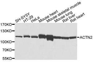Western blot analysis of extracts of various cell lines, using ACTN2 antibody. (ACTN2 抗体  (AA 1-250))
