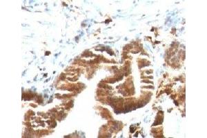 IHC testing of FFPE human gallbladder with TOP1MT antibody (clone TPIMT-1). (TOP1MT 抗体)