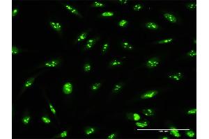 Immunofluorescence of purified MaxPab antibody to PWP2 on HeLa cell. (PWP2 抗体  (AA 1-919))