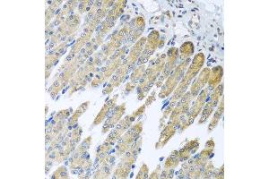 Immunohistochemistry of paraffin-embedded mouse stomach using NDUFB10 antibody at dilution of 1:100 (x40 lens).