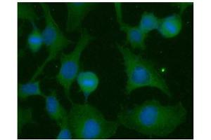 ICC/IF analysis of RAS in HeLa cells line, stained with DAPI (Blue) for nucleus staining and monoclonal anti-human RAS antibody (1:100) with goat anti-mouse IgG-Alexa fluor 488 conjugate (Green). (RAS 抗体  (AA 1-186))
