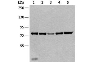 Western blot analysis of Mouse liver tissue Hela cell Human testis tissue Jurkat and HEPG2 cell lysates using ATF6B Polyclonal Antibody at dilution of 1:300