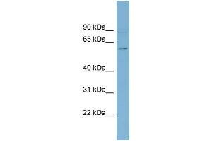 WB Suggested Anti-HSF5 Antibody Titration:  0. (HSF5 抗体  (Middle Region))