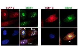 Immunofluorescence microscopy using  protein A purified anti-CENP-Q antibody shows detection of endogenous CENP-Q in HeLa whole cell lysate. (CENPQ 抗体)