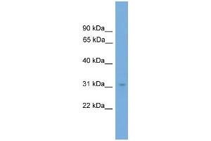 WB Suggested Anti-NRBF2  Antibody Titration: 0. (NRBF2 抗体  (N-Term))