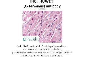 Image no. 1 for anti-HECT, UBA and WWE Domain Containing 1, E3 Ubiquitin Protein Ligase (HUWE1) antibody (ABIN1735641) (HUWE1 抗体)