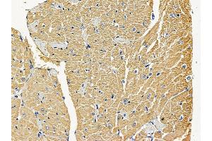 ABIN6258440 and ABIN6275234 at 1/100 staining mouse heart tissue by IHC-P. (MRPS22 抗体  (C-Term))