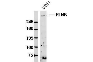 U251 lysates probed with FLNB Polyclonal Antibody, Unconjugated  at 1:300 dilution and 4˚C overnight incubation. (FLNB 抗体  (AA 1551-1650))