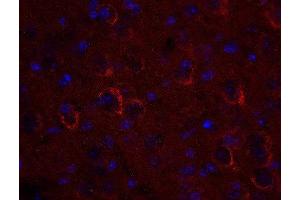 Indirect immunostaining of PFA fixed mouse brain section (dilution 1 : 500; red). (VTI1A 抗体  (AA 2-185))