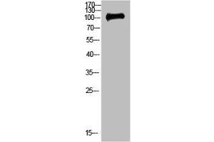 Western Blot analysis of 3T3 cells using Antibody diluted at 500. (CTNND1 抗体  (AA 841-890))