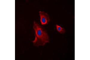 Immunofluorescent analysis of Histamine H2 Receptor staining in COLO205 cells. (HRH2 抗体  (Center))