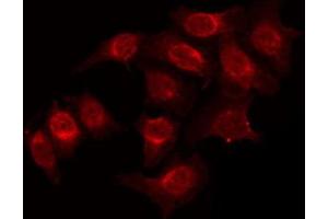 ABIN6272245 staining K562 by IF/ICC. (ARHGAP22 抗体  (C-Term))