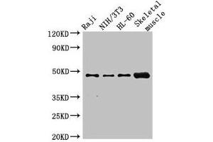 Western Blot Positive WB detected in: Raji whole cell lysate, NIH/3T3 whole cell lysate, HL60 whole cell lysate, Mouse skeletal muscle tissue All lanes: RBM22 antibody at 2. (RBM22 抗体  (AA 2-250))