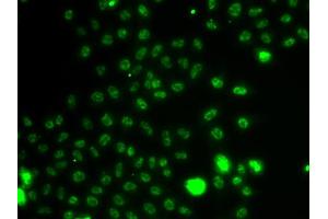 Immunofluorescence analysis of A549 cells using ETV1 antibody. (ETV1 抗体)