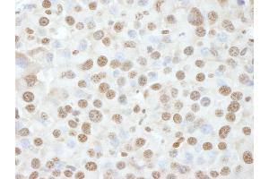 Immunohistochemistry (IHC) image for anti-Nuclear Casein Kinase and Cyclin-Dependent Kinase Substrate 1 (NUCKS1) (AA 1-50) antibody (ABIN7448993) (NUCKS1 抗体  (AA 1-50))
