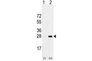 Image no. 1 for anti-Proteasome Subunit alpha 5 (PSMA5) (Middle Region) antibody (ABIN356946) (PSMA5 抗体  (Middle Region))
