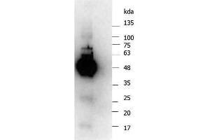 Western Blotting (WB) image for anti-Inhibitor of kappa Light Polypeptide Gene Enhancer in B-Cells, Kinase gamma (IKBKG) antibody (ABIN5706847)