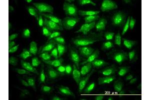 Immunofluorescence of monoclonal antibody to CDKN1B on HeLa cell. (CDKN1B 抗体  (AA 1-198))