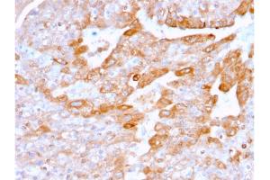 Immunohistochemistry (IHC) image for anti-Tumor Necrosis Factor Receptor Superfamily, Member 9 (TNFRSF9) (AA 19-188) antibody (ABIN6939788)