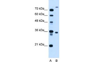 WB Suggested Anti-FLJ22167 Antibody Titration:  1. (FLJ22167 (N-Term) 抗体)