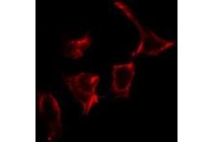 Immunofluorescence (fixed cells) (IF/ICC) image for anti-Nuclear Receptor Subfamily 4, Group A, Member 3 (NR4A3) antibody (ABIN6263724)