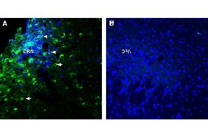 Expression of Glycine Receptor alpha 3 in rat dorsal raphe nucleus (DRN).