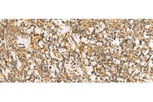 Immunohistochemistry of paraffin-embedded Human tonsil tissue using DNAJA4 Polyclonal Antibody at dilution of 1:55(x200) (DNAJA4 抗体)