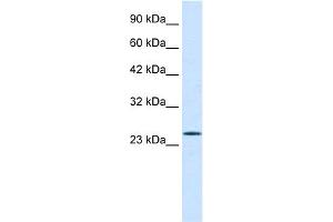 WB Suggested Anti-PCGF3 Antibody Titration:  0. (PCGF3 抗体  (Middle Region))