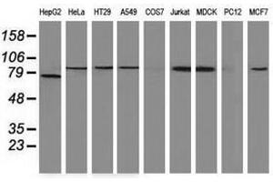 Image no. 3 for anti-Catenin (Cadherin-Associated Protein), beta 1, 88kDa (CTNNB1) antibody (ABIN1496891) (CTNNB1 抗体)