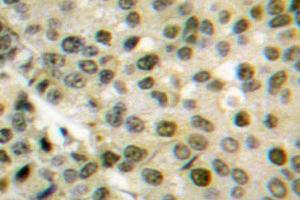 Image no. 1 for anti-V-Akt Murine Thymoma Viral Oncogene Homolog 1 (AKT1) antibody (ABIN271867) (AKT1 抗体)