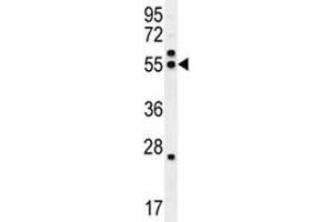 TUBB8B antibody western blot analysis in HeLa lysate. (Tubulin, beta 8 抗体  (AA 320-347))