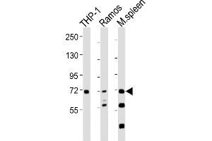 All lanes : Anti-SYK Antibody at 1:2000 dilution Lane 1: THP-1 whole cell lysates Lane 2: Ramos whole cell lysates Lane 3: mouse spleen lysates Lysates/proteins at 20 μg per lane. (SYK 抗体  (AA 268-305))