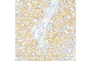 Immunohistochemistry (Paraffin-embedded Sections) (IHC (p)) image for anti-Glucosidase, Beta, Acid (GBA) antibody (ABIN7074062)