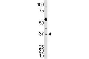 Image no. 1 for anti-DKK3 (N-Term) antibody (ABIN357071) (DKK3 抗体  (N-Term))