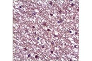 Immunohistochemical staining of formalin-fixed paraffin-embedded human heart showing staining with ANGPT1 polyclonal antibody  at 1:100 dilution. (Angiopoietin 1 抗体)