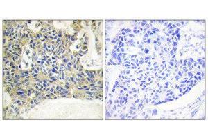Immunohistochemistry (IHC) image for anti-Protein Kinase C, theta (PRKCQ) (pSer695) antibody (ABIN1847342) (PKC theta 抗体  (pSer695))