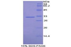 SDS-PAGE (SDS) image for Tubulin, delta 1 (TUBD1) (AA 238-482) protein (His tag) (ABIN2127116) (TUBD1 Protein (AA 238-482) (His tag))