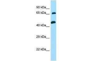 WB Suggested Anti-TXLNA Antibody Titration: 1. (alpha Taxilin 抗体  (C-Term))