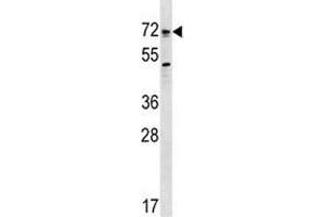 Bmpr1a antibody western blot analysis in SK-BR-3 lysate. (BMPR1A 抗体  (AA 170-197))